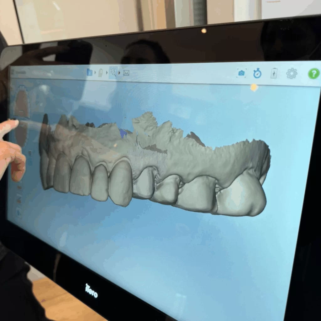 Reabilitação Dentária em Niteroi